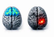 Digital Detox For Mental Clarity: How Screen Time Affects Your Brain 21 Digital detox brain illustration. Brain scan comparison showing reduced prefrontal cortex activity and increased amygdala reactivity in heavy screen users versus balanced digital use patterns.